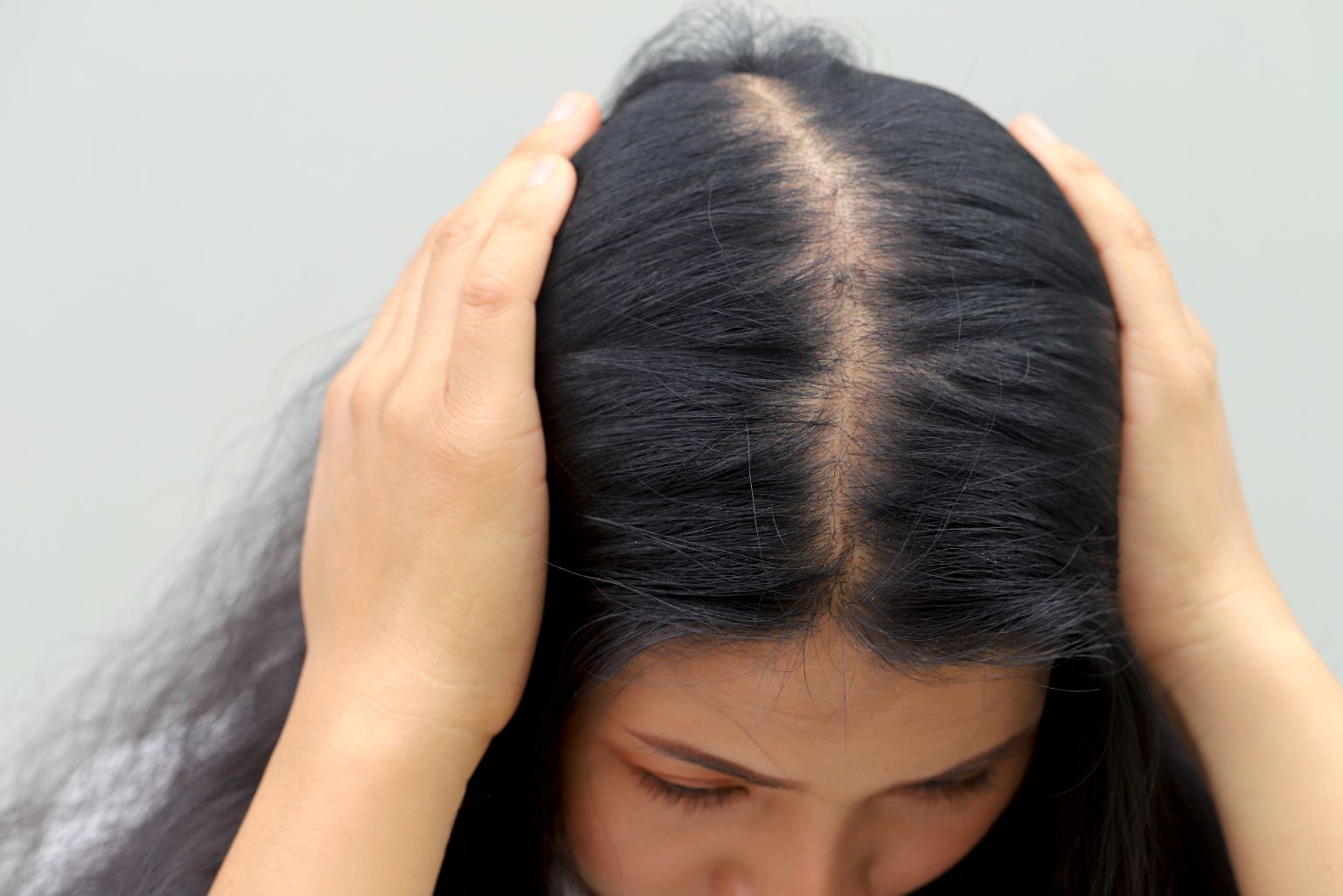 Raktamokshana for Alopecia Ayurvedic Blood Cleansing for Hair Regrowth